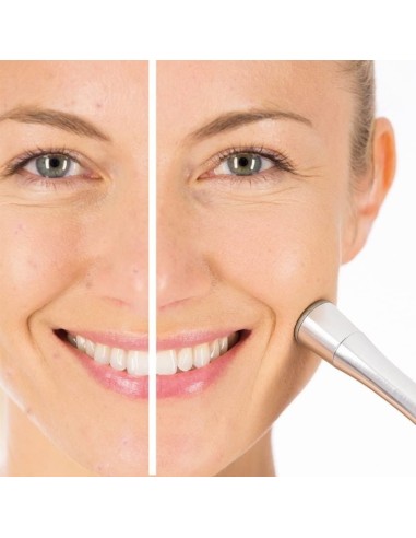 Beurer FC 100 Pureo Derma Peel