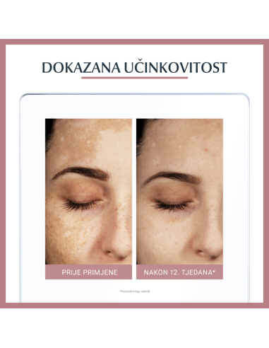 Eucerin Anti-Pigment dvofazni tretman 66883