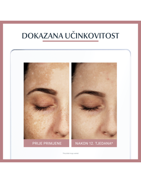 Eucerin Anti-Pigment dvofazni tretman 66883
