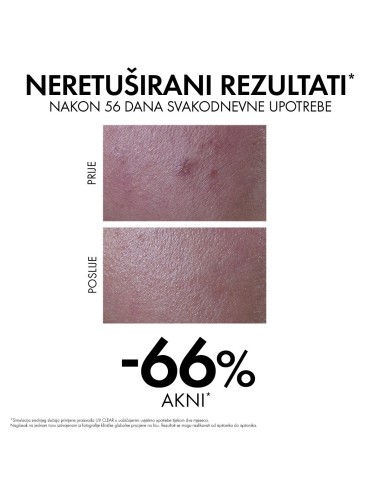 Vichy Capital Soleil UV-Clear Fluid za zaštitu od sunca protiv nepravilnosti SPF50+