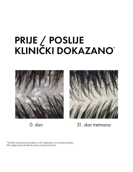 Vichy Dercos Šampon protiv prhuti DS - 2 u 1: Dermokozmetički šampon i regenerator
