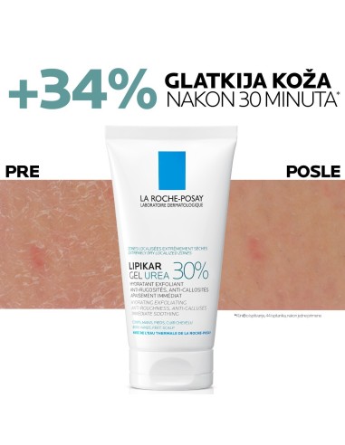 La Roche-Posay Lipikar gel s 30% ureje za ciljanu primjenu na suha i gruba područja kože