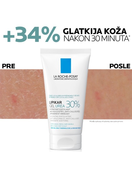 La Roche-Posay Lipikar gel s 30% ureje za ciljanu primjenu na suha i gruba područja kože