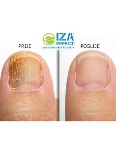 Iza Effect Sprej protiv gljivica na noktima i stopalima 2