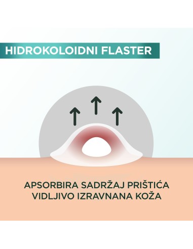 Garnier Pure Active flaster za prištiće