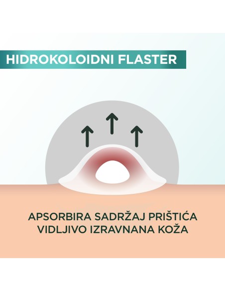 Garnier Pure Active flaster za prištiće