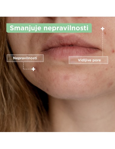 Mixa Fluid protiv nepravilnosti 50 ml