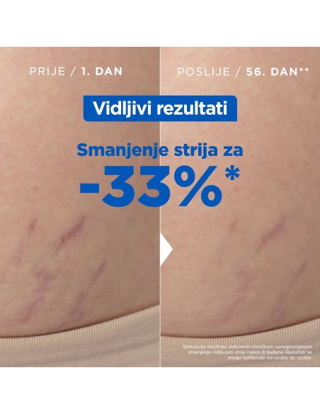 Mixa Ulje protiv strija 100 ml