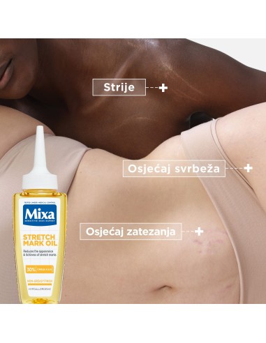 Mixa Ulje protiv strija 100 ml