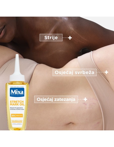 Mixa Ulje protiv strija 100 ml