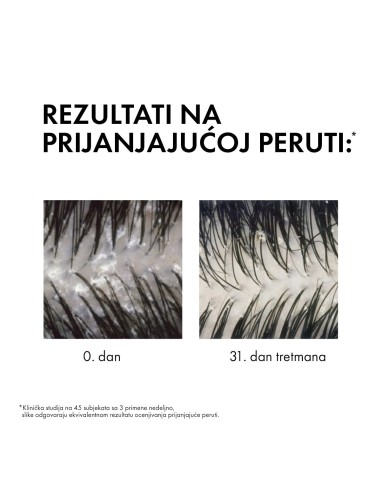 Vichy Dercos Šampon protiv prhuti za normalnu/masnu kosu Refill 390 ml