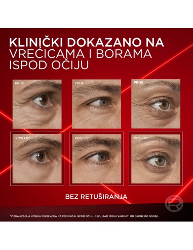 L'Oreal Paris Revitalift Laser krema protiv podočnjaka 15ml