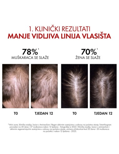 Vichy Dercos Aminexil Clinical R.E.G.E.N Booster Serum za obnovu kose