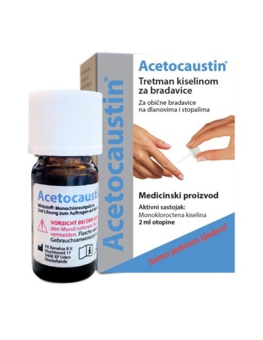 Acetocaustin tretman kiselinom za bradavice