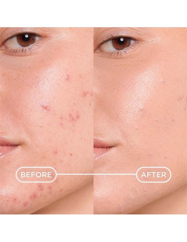 Bioderma Sebium Kerato+ Cover gel krema