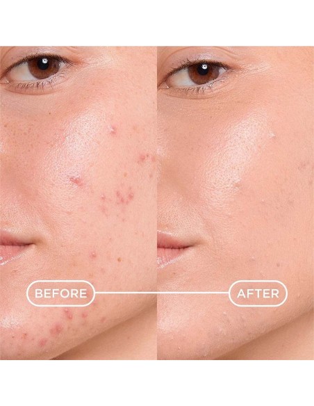 Bioderma Sebium Kerato+ Cover gel krema