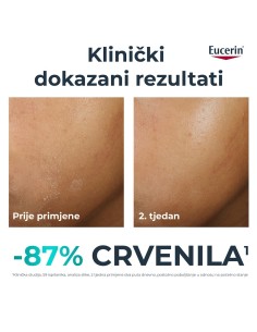 Eucerin DermoPure Clinical dopunska umirujuća krema 99308 2