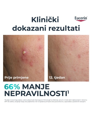 Eucerin DermoPure Clinical serum s trostrukim djelovanjem 66862