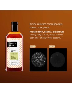 Nuggela & Sule Anti-Dandruff Šampon protiv prhuti 2