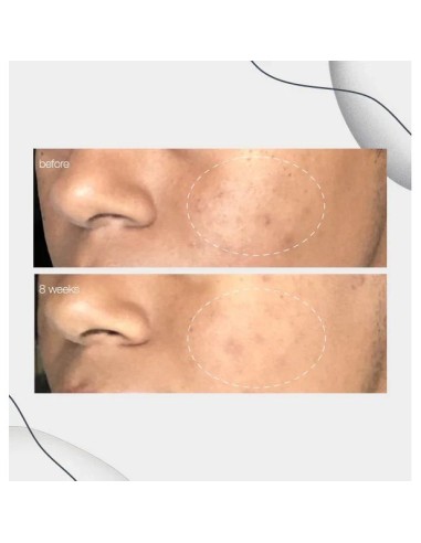 Dermalogica Powerbright Dark Spot Serum