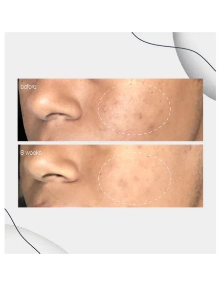 Dermalogica Powerbright Dark Spot Serum