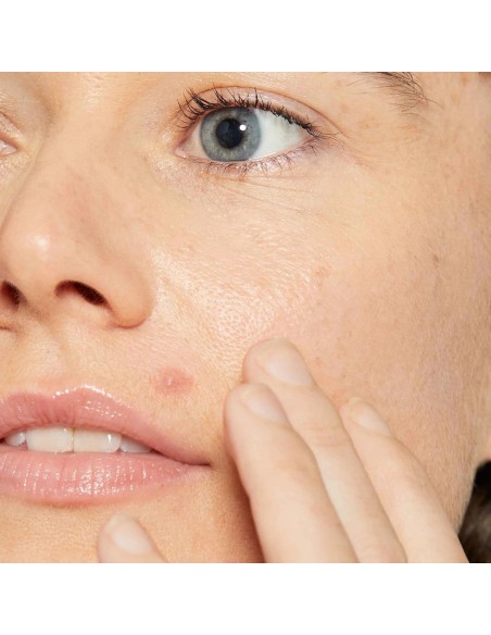 Dermalogica Deep Breakout Liquid Patch