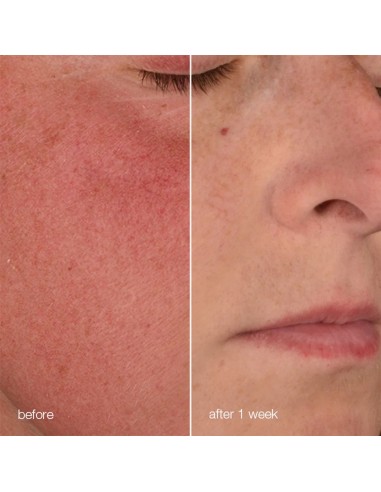 Dermalogica Stabilizing Repair Cream